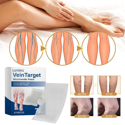 Varicose Vein Relief Patches with Cooling Plant Extracts Non Greasy Promotes Blood Circulation Lightweight Easy to Apply